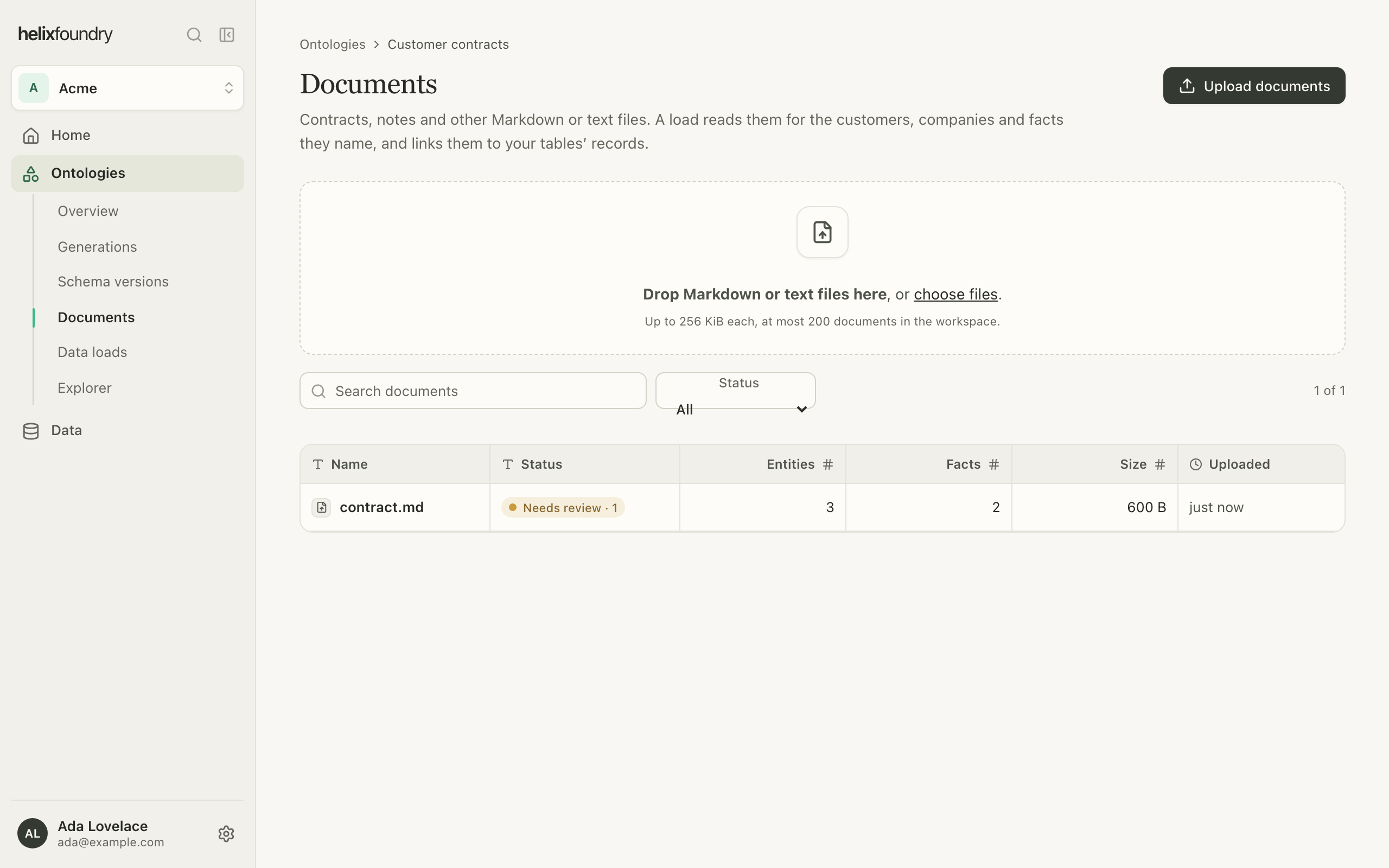 The Documents list with contract.md read and one item needing review